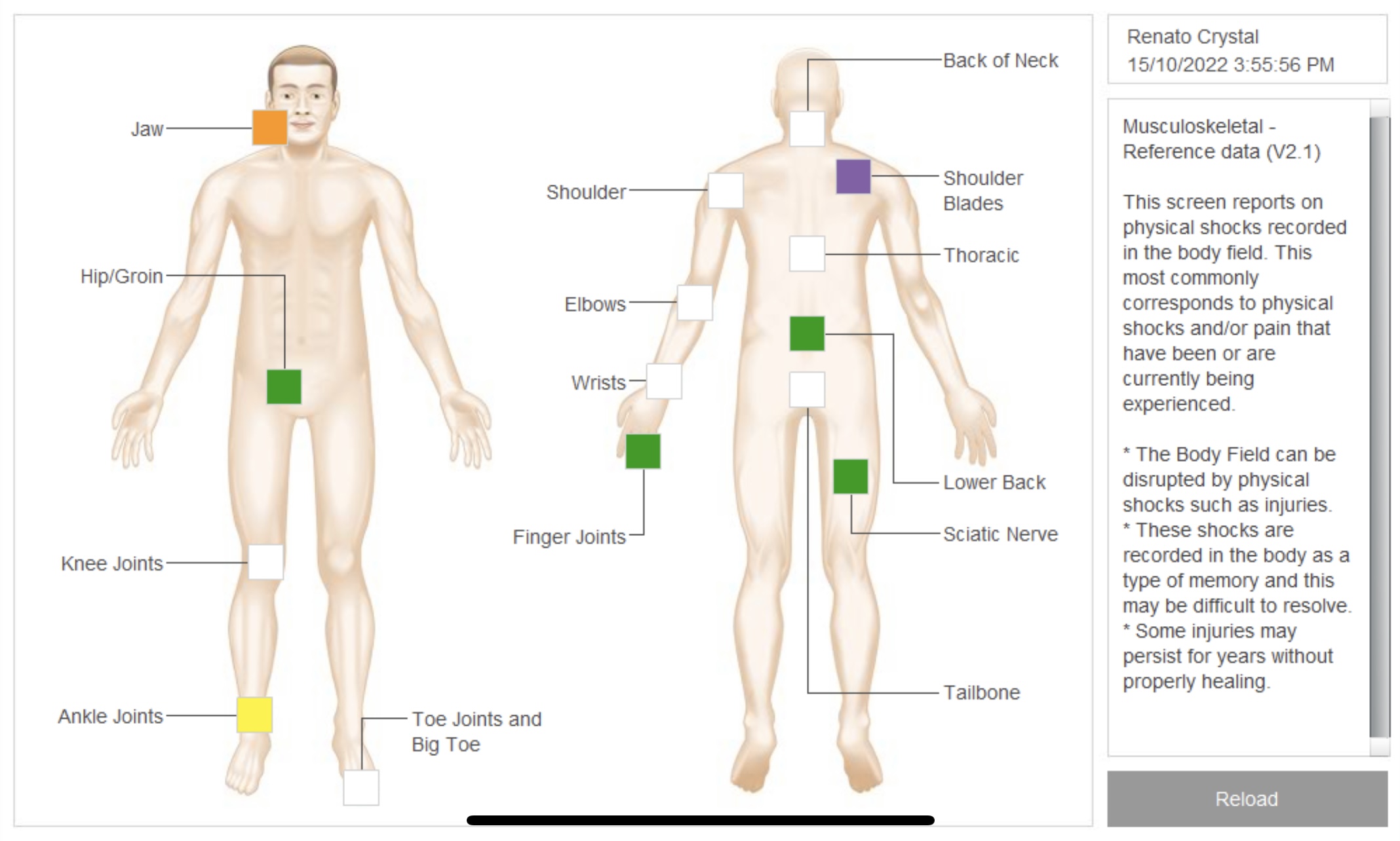 Buy NES Bioenergetics In-Person Scan Session - Assessment & Report $170 - Image 3